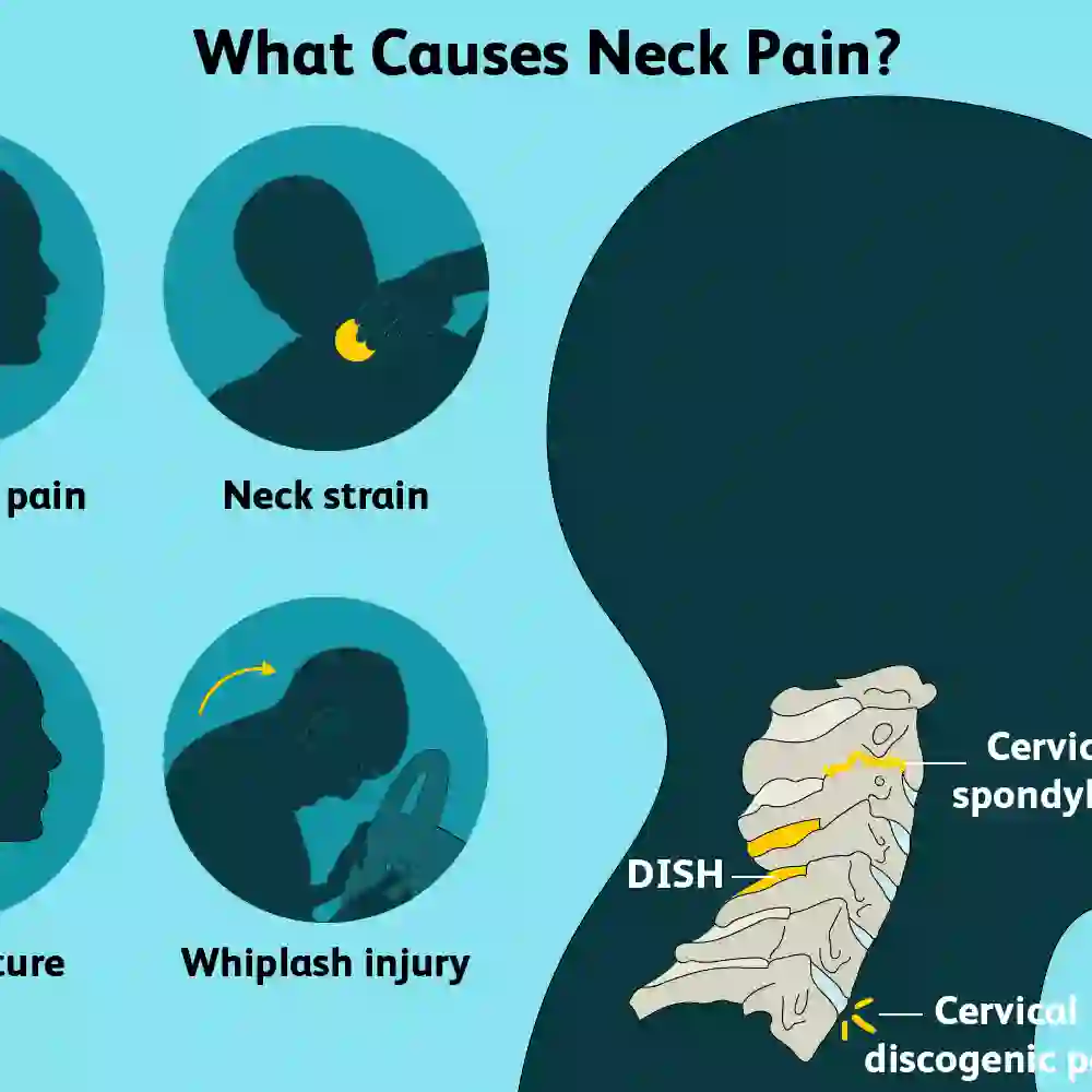 What is neck pain?