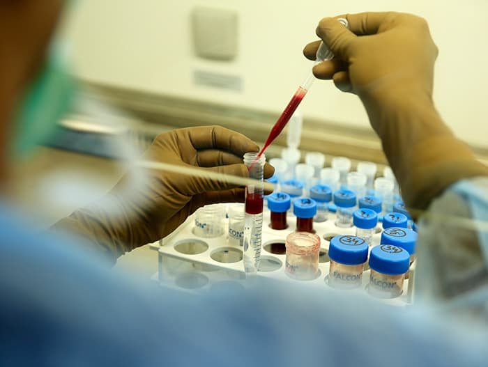how to stem cell therapy work do you know